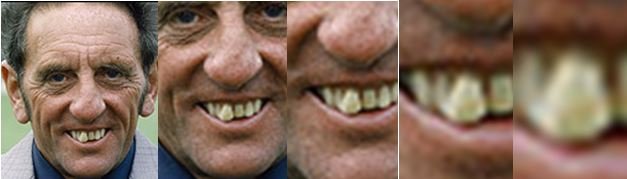 Jimmy SIrrels Tooth.JPG