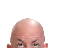 bald head.jpg
