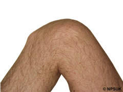 knees3.jpg