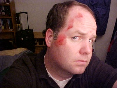 FaceFrontView2.JPG